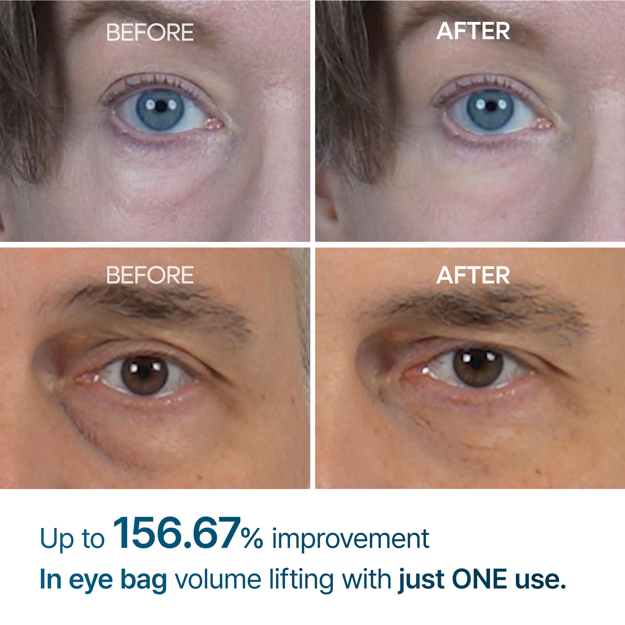 [SPECIAL 1+1 DEAL] Eyephalt eyebag cream